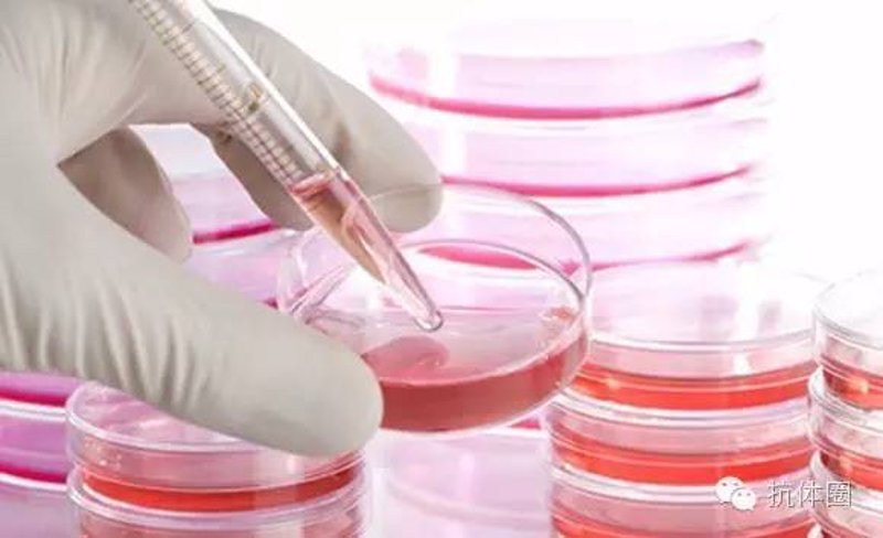 在生物医学领域,抗体定制已经成为一个不可或缺的技术环节。如何选择合适的抗体?本文将通过比较分析两种主要的抗体供应商,帮助科研人员做出明智的选择。